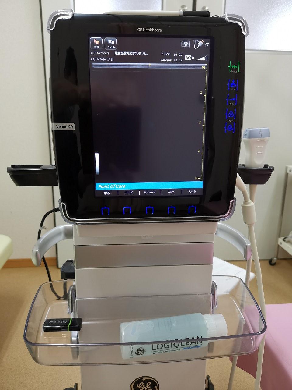 超音波診断装置